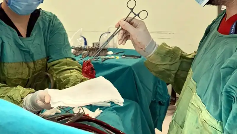 Kalp Kapağı Çürüyen Hastaya Yapılan 7 Saatlik Ameliyat: "Mucizevi Bir Başarı"